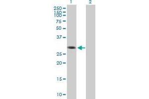 anti-Gem (Nuclear Organelle) Associated Protein 2 (GEMIN2) (AA 1-280) antibody