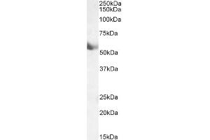 Image no. 3 for anti-Cytochrome P450, Family 1, Subfamily A, Polypeptide 1 (CYP1A1) (Internal Region) antibody (ABIN870663)