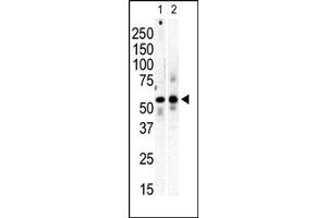 PI4K2B Antikörper  (C-Term)