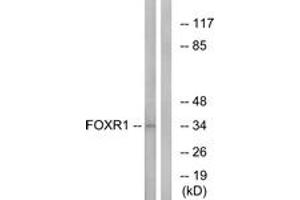 Image no. 1 for anti-Forkhead Box R1 (FOXR1) (AA 231-280) antibody (ABIN1534912)