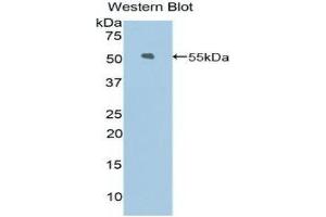anti-Kinesin Family Member 5A (KIF5A) (AA 823-1027) antibody