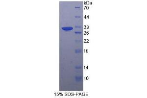 Image no. 1 for Filamin B, beta (FLNB) (AA 1-237) protein (His tag) (ABIN1981174)