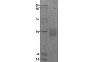 Image no. 1 for CD8b Molecule (CD8B) (Transcript Variant 6) protein (His tag) (ABIN2713780)