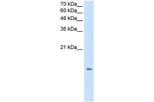 Image no. 2 for anti-Microsomal Glutathione S-Transferase 2 (MGST2) (N-Term) antibody (ABIN630237)