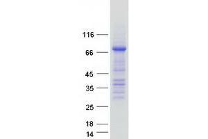 Image no. 1 for Occludin (OCLN) protein (Myc-DYKDDDDK Tag) (ABIN2727862)