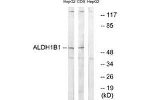 Image no. 1 for anti-Aldehyde Dehydrogenase 1 Family, Member B1 (ALDH1B1) (AA 311-360) antibody (ABIN1534614)