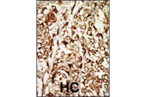 Image no. 3 for anti-Moloney Sarcoma Oncogene (MOS) (AA 1-30), (N-Term) antibody (ABIN392644)