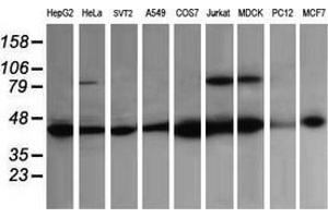 Image no. 2 for anti-Acetyl-CoA Acyltransferase 2 (ACAA2) antibody (ABIN2715630)