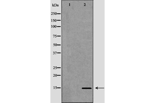 anti-Potassium Voltage-Gated Channel, Isk-Related Family, Member 1 (KCNE1) (Internal Region) antibody
