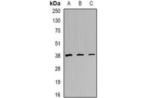 Image no. 1 for anti-three Prime Repair Exonuclease 1 (TREX1) (full length) antibody (ABIN6004398)