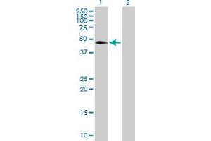 Image no. 1 for anti-CDC42 Effector Protein (Rho GTPase Binding) 4 (CDC42EP4) (AA 1-356) antibody (ABIN525278)