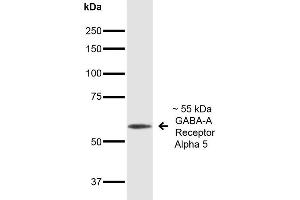 Image no. 2 for anti-gamma-aminobutyric Acid (GABA) A Receptor, alpha 5 (GABRA5) (AA 368-419), (Cytoplasmic Domain) antibody (PE) (ABIN2485768)
