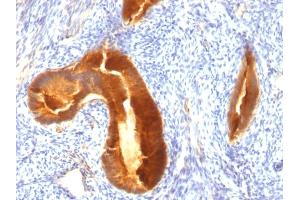 Image no. 3 for anti-Mucin 1 (MUC1) antibody (ABIN6940096)
