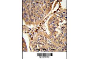 Image no. 1 for anti-Peroxisomal Biogenesis Factor 16 (PEX16) (AA 247-275) antibody (ABIN653096)