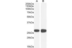 Image no. 5 for anti-Stratifin (SFN) (Internal Region) antibody (ABIN185539)