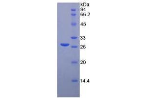 Image no. 1 for Matrix Metalloproteinase 2 (MMP2) ELISA Kit (ABIN6730864)