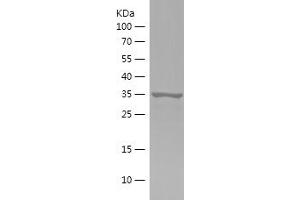 PIN4 Protein (AA 1-131) (IF2DI tag)