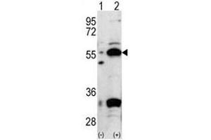 Image no. 1 for anti-Pyruvate Dehydrogenase Complex, Component X (PDHX) (C-Term) antibody (ABIN357414)