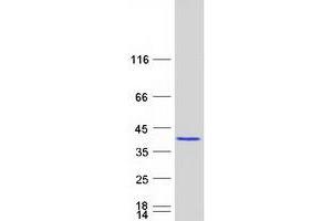 Image no. 1 for Phosducin-Like 3 (PDCL3) protein (Myc-DYKDDDDK Tag) (ABIN2728469)