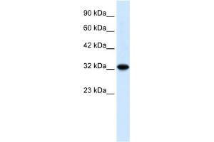 Image no. 3 for anti-Zinc Finger and BTB Domain Containing 32 (ZBTB32) (N-Term) antibody (ABIN2777470)