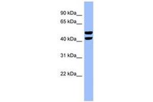 Image no. 1 for anti-6-phosphofructo-2-Kinase/fructose-2,6-Biphosphatase 4 (PFKFB4) (N-Term) antibody (ABIN6741800)