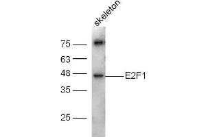 Image no. 3 for anti-E2F Transcription Factor 1 (E2F1) (AA 101-180) antibody (ABIN670686)