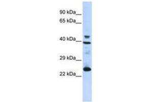 Image no. 1 for anti-Selenoprotein P (SEPP1) (AA 35-84) antibody (ABIN6743265)