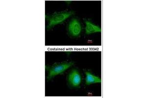 ICC/IF Image Immunofluorescence analysis of methanol-fixed HeLa, using HSC70, antibody at 1:200 dilution.
