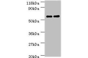 Western blot All lanes: Ces1c antibody at 2 μg/mL Lane 1: Mouse liver tissue Lane 2: Rat liver tissue Secondary Goat polyclonal to rabbit IgG at 1/10000 dilution Predicted band size: 62 kDa Observed band size: 62 kDa