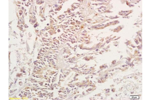 Adenosine A3 Receptor anticorps  (AA 85-180)