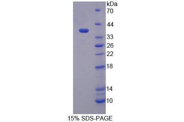 Peroxisomal Biogenesis Factor 19 (PEX19) protein