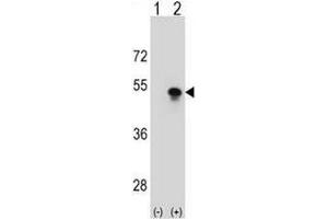 Image no. 2 for anti-Small Nuclear RNA Activating Complex, Polypeptide 1, 43kDa (SNAPC1) (AA 138-168), (Middle Region) antibody (ABIN954868)