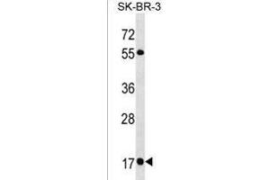 RAB19 Antibody (N-term) (ABIN1538880 and ABIN2850090) western blot analysis in SK-BR-3 cell line lysates (35 μg/lane).