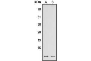Image no. 2 for anti-NADH Dehydrogenase (Ubiquinone) 1 alpha Subcomplex, 3, 9kDa (NDUFA3) (Center) antibody (ABIN2706657)