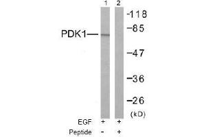 Image no. 3 for anti-3-phosphoinositide Dependent Protein Kinase-1 (PDPK1) (Ser241) antibody (ABIN197100)