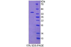 Image no. 1 for phosphodiesterase 4B, cAMP-Specific (PDE4B) (AA 500-736) protein (His tag) (ABIN6237842)