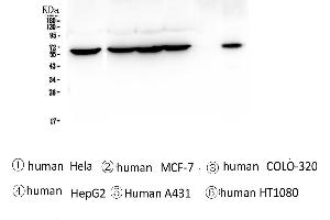 Image no. 1 for anti-T-Complex 1 (TCP1) (AA 515-551), (C-Term) antibody (ABIN5693078)