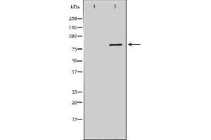 Image no. 3 for anti-DNA Cross-Link Repair 1C (DCLRE1C) antibody (ABIN6261238)