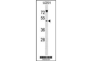 Image no. 1 for anti-Integrin-Linked Kinase-Associated Serine/threonine Phosphatase 2C (ILKAP) (AA 93-122) antibody (ABIN1881459)