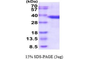 Image no. 1 for serine/arginine-Rich Splicing Factor 1 (SRSF1) (AA 1-248) protein (His tag) (ABIN5854856)