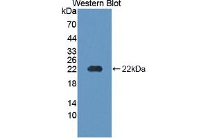 Image no. 2 for anti-Parathyroid Hormone 1 Receptor (PTH1R) (AA 28-188) antibody (ABIN1870093)