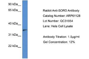 Image no. 1 for anti-Sorbitol Dehydrogenase (SORD) (N-Term) antibody (ABIN2788686)