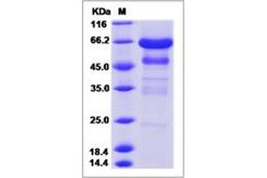 Image no. 1 for Insulin-Like Growth Factor Binding Protein 2, 36kDa (IGFBP2) (AA 1-305) protein (Fc Tag) (ABIN2693484)