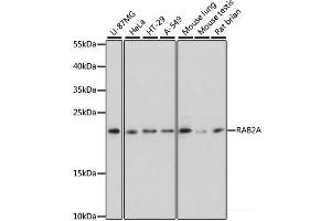Western blot analysis of extracts of various cell lines using RAB2A Polyclonal Antibody at dilution of 1:3000.