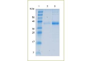 Image no. 2 for Interleukin 12 beta (IL12B) (AA 23-328) protein (His tag) (ABIN1019696)