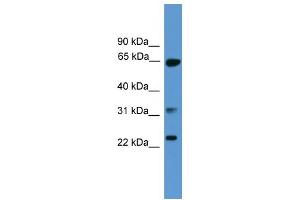 Image no. 1 for anti-Clathrin, Light Chain A (CLTA) (C-Term) antibody (ABIN2788075)