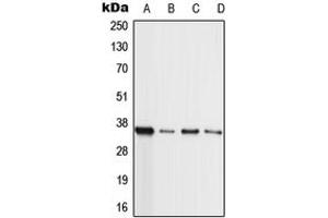 Image no. 1 for anti-Histone-Lysine N-Methyltransferase MLL4 (MLL4) (Center) antibody (ABIN2706561)