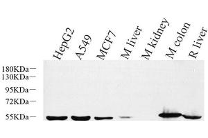 Western Blot analysis of various samples using CK-8 Polyclonal Antibody at dilution of 1:1000.
