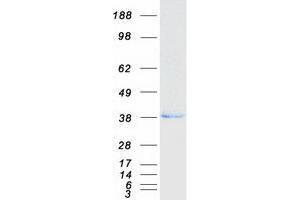 Image no. 1 for Esterase D (ESD) protein (Myc-DYKDDDDK Tag) (ABIN2720524)