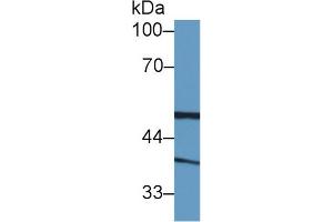 Image no. 1 for anti-Biliverdin Reductase A (BLVRA) (AA 1-125) antibody (ABIN1866905)